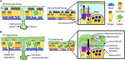 Challenges Facing Airway Epithelial Cell-Based Therapy for Cystic Fibrosis